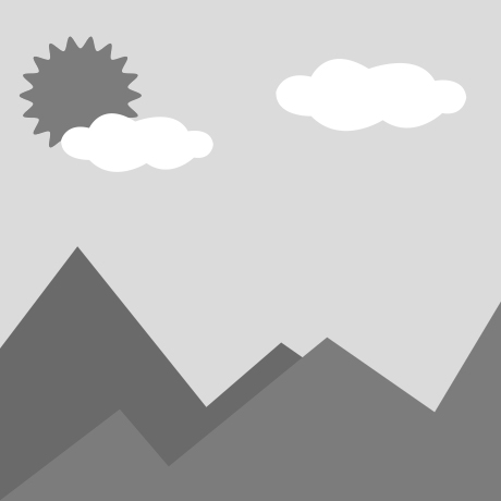 What are the advantages of chain and sprocket in power transmission?